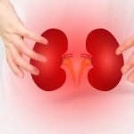 Kidney failure